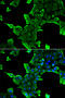 Neuronal calcium sensor 1 antibody, STJ28538, St John