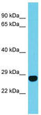 Family With Sequence Similarity 204 Member A antibody, TA330713, Origene, Western Blot image 