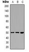Zinc finger FYVE domain-containing protein 19 antibody, orb318837, Biorbyt, Western Blot image 