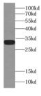 Complement C4-A antibody, FNab01112, FineTest, Western Blot image 