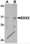 Quiescin Sulfhydryl Oxidase 1 antibody, 5583, ProSci, Western Blot image 