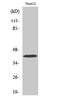 Ribosomal protein S6 modification-like protein B antibody, A14138, Boster Biological Technology, Western Blot image 