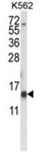Histone Cluster 1 H2A Family Member H antibody, AP18046PU-N, Origene, Western Blot image 
