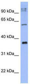 Potassium Channel Tetramerization Domain Containing 4 antibody, TA338794, Origene, Western Blot image 