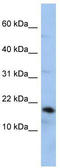 TP antibody, TA335057, Origene, Western Blot image 