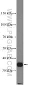 Leucine Rich Repeat Containing 59 antibody, 27208-1-AP, Proteintech Group, Western Blot image 