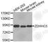 Zinc Finger DHHC-Type Containing 5 antibody, A3405, ABclonal Technology, Western Blot image 