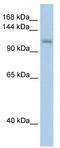 Pre-MRNA Processing Factor 6 antibody, TA343788, Origene, Western Blot image 