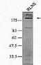 Nucleoporin 210 antibody, PA1-29888, Invitrogen Antibodies, Western Blot image 