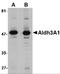 Aldehyde Dehydrogenase 3 Family Member A1 antibody, 4787, ProSci, Western Blot image 