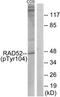 DNA repair protein RAD52 homolog antibody, TA314419, Origene, Western Blot image 