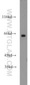 CaM Kinase Like Vesicle Associated antibody, 14788-1-AP, Proteintech Group, Western Blot image 