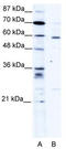 PDZ and LIM domain protein 5 antibody, TA336116, Origene, Western Blot image 