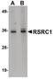 Arginine And Serine Rich Coiled-Coil 1 antibody, PA5-20899, Invitrogen Antibodies, Western Blot image 