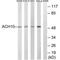 Cholinergic Receptor Nicotinic Alpha 10 Subunit antibody, PA5-50074, Invitrogen Antibodies, Western Blot image 