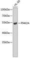 Phosphatidylinositol 4-kinase type 2-alpha antibody, 22-754, ProSci, Western Blot image 
