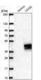 V-Set And Immunoglobulin Domain Containing 2 antibody, PA5-62144, Invitrogen Antibodies, Western Blot image 