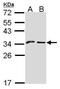 Killer Cell Lectin Like Receptor C1 antibody, PA5-21949, Invitrogen Antibodies, Western Blot image 