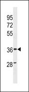 Zinc Finger CCCH-Type Containing, Antiviral 1 Like antibody, PA5-49243, Invitrogen Antibodies, Western Blot image 