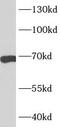 Cell division control protein 6 homolog antibody, FNab01537, FineTest, Western Blot image 