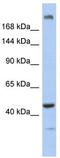 Centrosomal Protein 170B antibody, TA334090, Origene, Western Blot image 