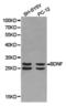 proBDNF antibody, TA327032, Origene, Western Blot image 