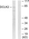 Doublecortin Like Kinase 2 antibody, LS-C119143, Lifespan Biosciences, Western Blot image 