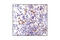 Kinase Insert Domain Receptor antibody, 2479S, Cell Signaling Technology, Immunohistochemistry paraffin image 