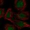 Retinoic Acid Receptor Alpha antibody, HPA058282, Atlas Antibodies, Immunofluorescence image 