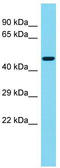 KIAA1257 antibody, TA331818, Origene, Western Blot image 