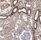Dihydrolipoamide Branched Chain Transacylase E2 antibody, NBP1-85963, Novus Biologicals, Immunohistochemistry paraffin image 