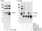 TPX2 Microtubule Nucleation Factor antibody, A300-429A, Bethyl Labs, Immunoprecipitation image 