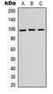 ATPase H+ Transporting V0 Subunit A2 antibody, LS-C354549, Lifespan Biosciences, Western Blot image 