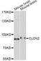 Chloride Voltage-Gated Channel 2 antibody, A6120, ABclonal Technology, Western Blot image 