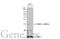 CDKN2A antibody, GTX135120, GeneTex, Western Blot image 
