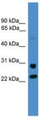 Malectin antibody, TA339315, Origene, Western Blot image 