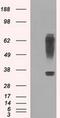 Ring Finger Protein 144B antibody, MA5-24997, Invitrogen Antibodies, Western Blot image 