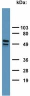 Keratin 17 antibody, GTX20670, GeneTex, Western Blot image 