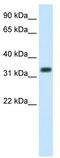 Siah E3 Ubiquitin Protein Ligase 1 antibody, TA335795, Origene, Western Blot image 