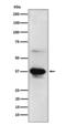 ICAD antibody, M03671-1, Boster Biological Technology, Western Blot image 