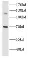 Death Domain Associated Protein antibody, FNab02249, FineTest, Western Blot image 