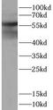 Keratin 5 antibody, FNab09935, FineTest, Western Blot image 