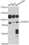 ADAM Metallopeptidase Domain 32 antibody, LS-C749960, Lifespan Biosciences, Western Blot image 