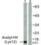 Histone Cluster 4 H4 antibody, LS-C120517, Lifespan Biosciences, Western Blot image 