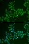 Carnitine O-Acetyltransferase antibody, abx004865, Abbexa, Western Blot image 
