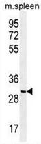 Coiled-Coil Domain Containing 84 antibody, AP50793PU-N, Origene, Western Blot image 