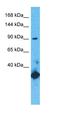 Glutamate Ionotropic Receptor NMDA Type Subunit 1 antibody, orb324602, Biorbyt, Western Blot image 