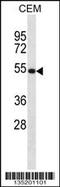 Netrin 3 antibody, 58-068, ProSci, Western Blot image 