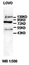 Solute Carrier Family 15 Member 1 antibody, orb77282, Biorbyt, Western Blot image 