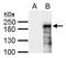 Putative Polycomb group protein ASXL1 antibody, GTX127284, GeneTex, Western Blot image 